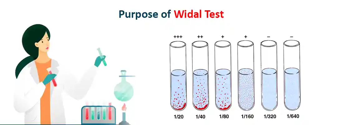 Purpose of the Widal Test